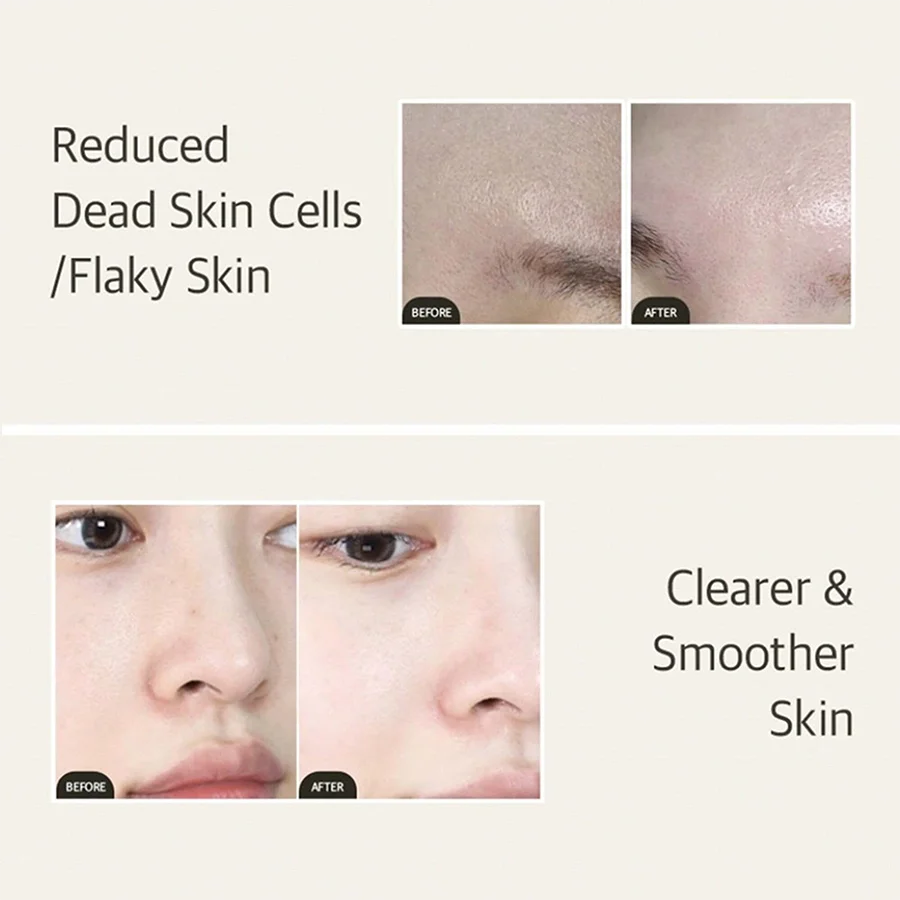 Mixsoon Bean Essence Vegansnail Exfoliating Essence for face Hydrating Korean Skin Care Glassskin Gentle Deep Hydration 50ml